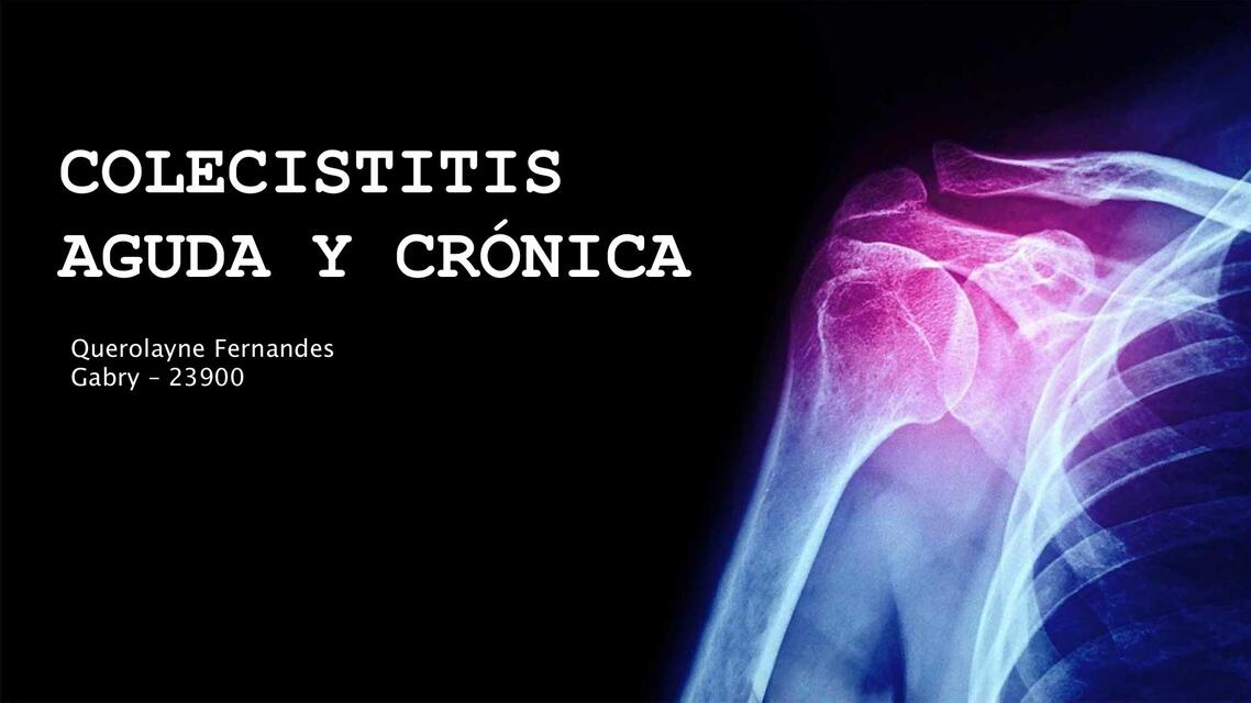 COLECISTITIS AGUDA Y CRONICA qfg