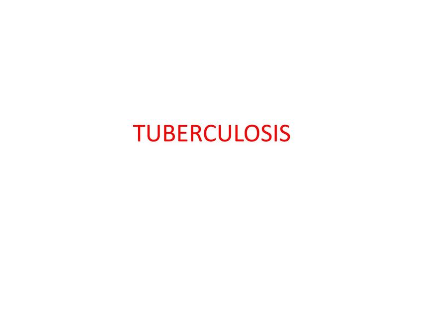 Tuberculosis