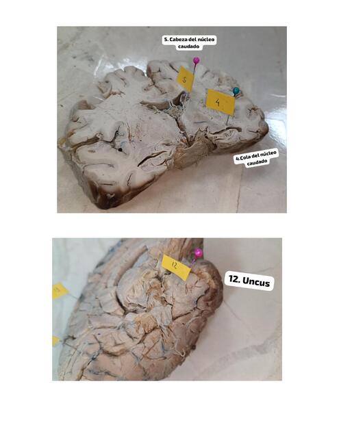 anatpmia imagnes