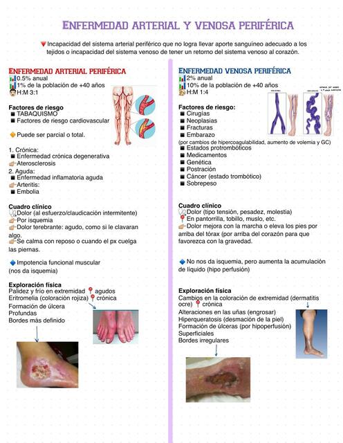 Insuficiencia arterial y venosa