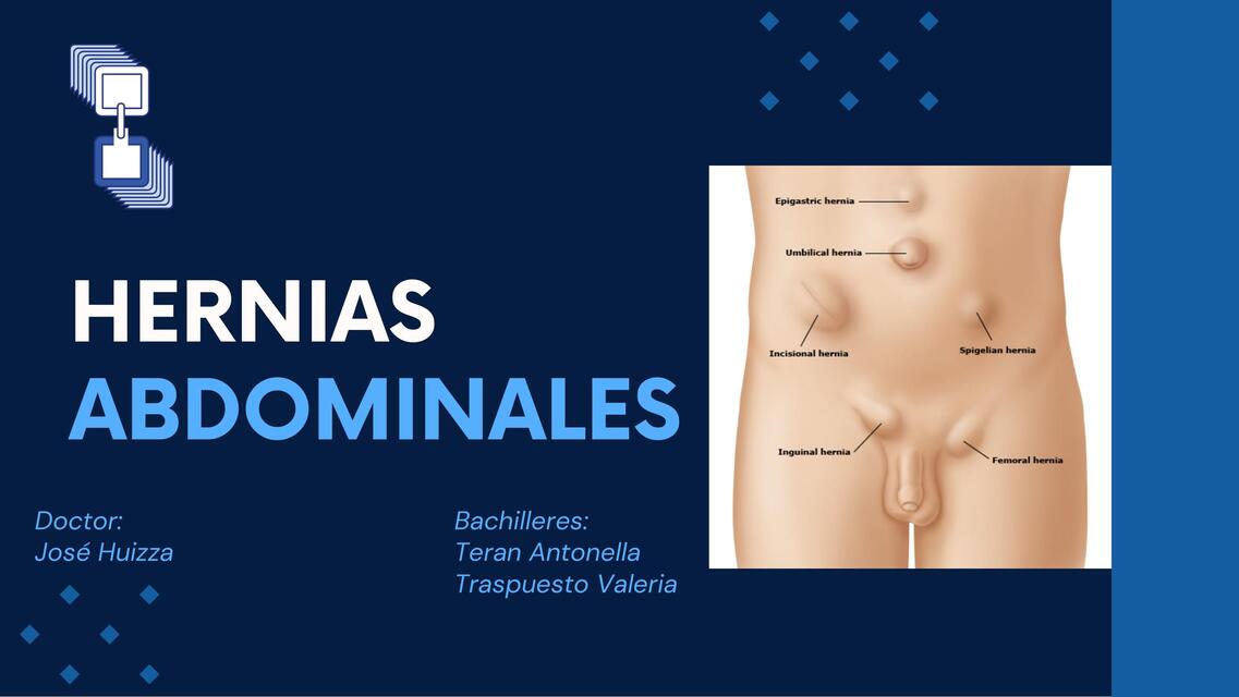 Hernias abdominales