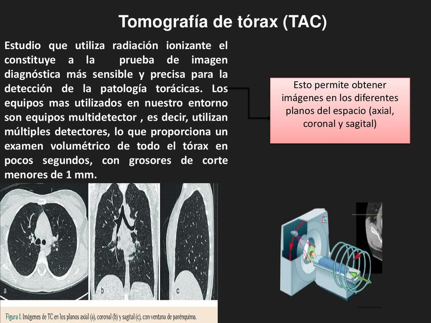 TC TORAX DEF