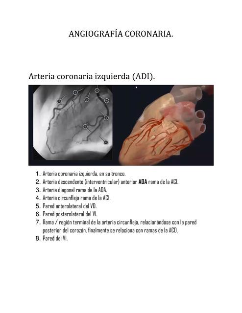 ANGIOGRAFiA CORONARIA