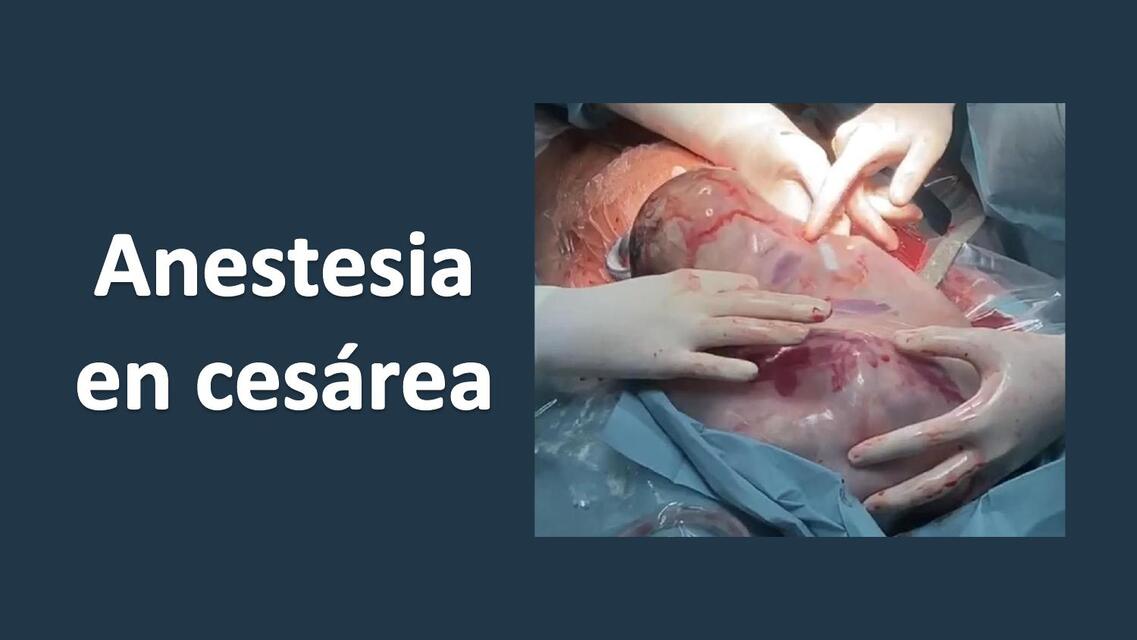 ANESTESIA EN CESÁREA