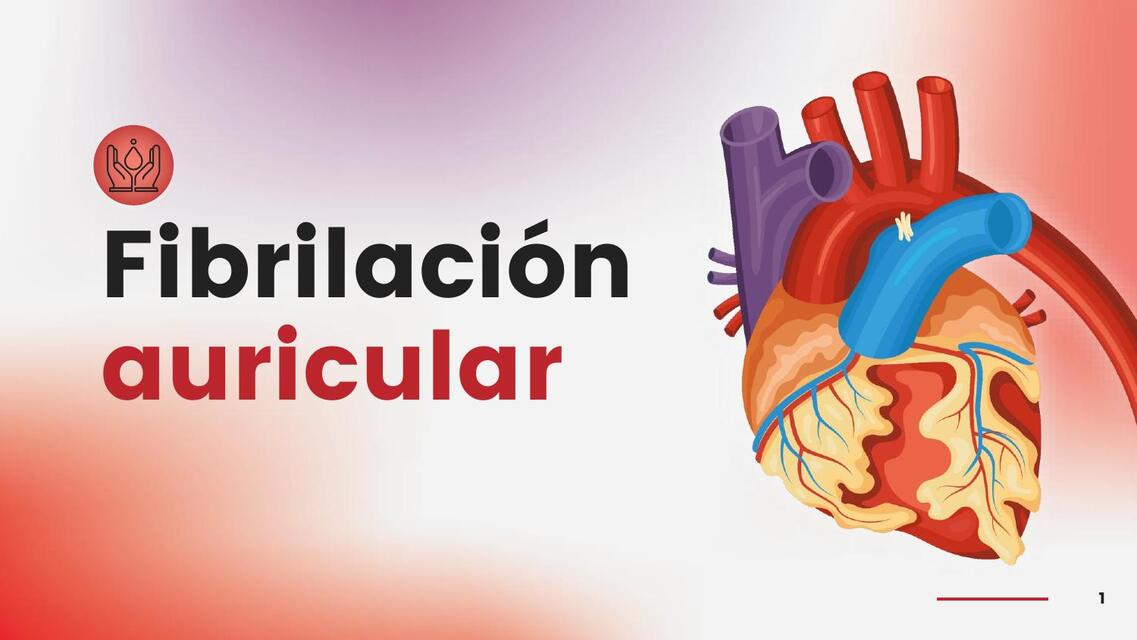 FIBRILACIÓN AURICULAR