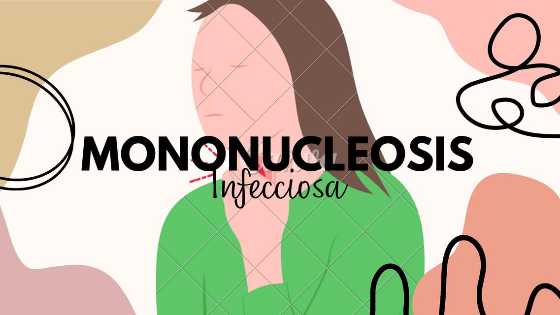 Mononucleosis