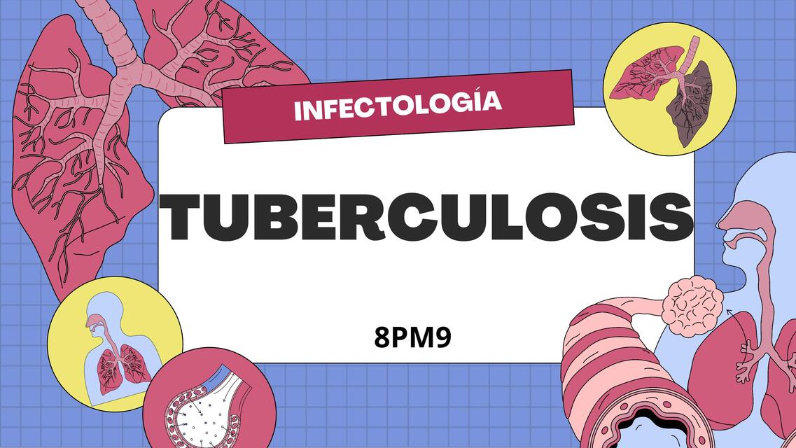 Tuberculosis