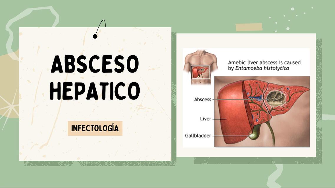 Absceso hepático