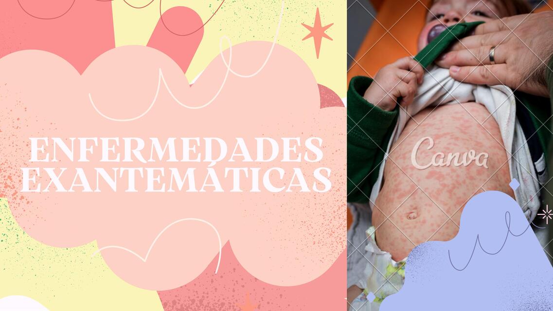 Enfermedades exantemáticas