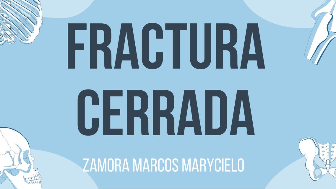 fractura cerrada