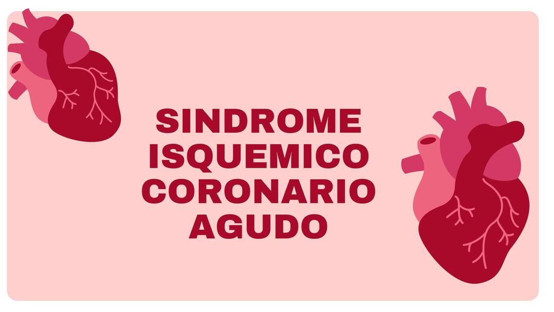 SINDROME ISQUEMICO CORONARIO AGUDO