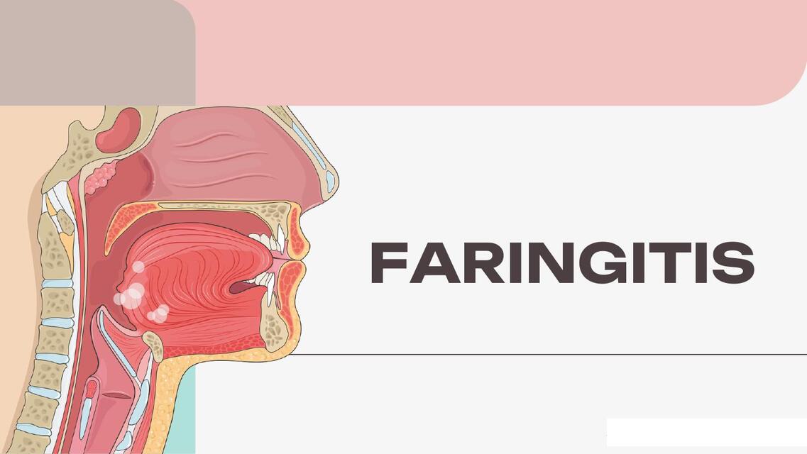 FARINGITIS