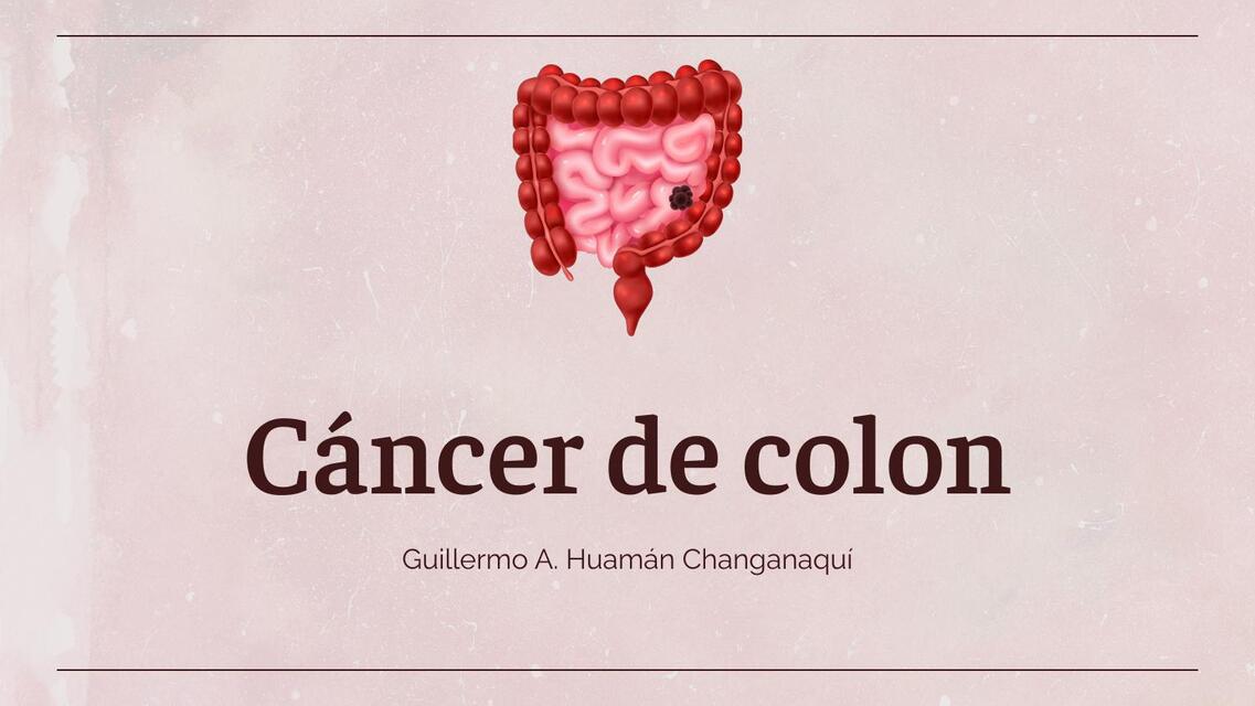 Cáncer de colon