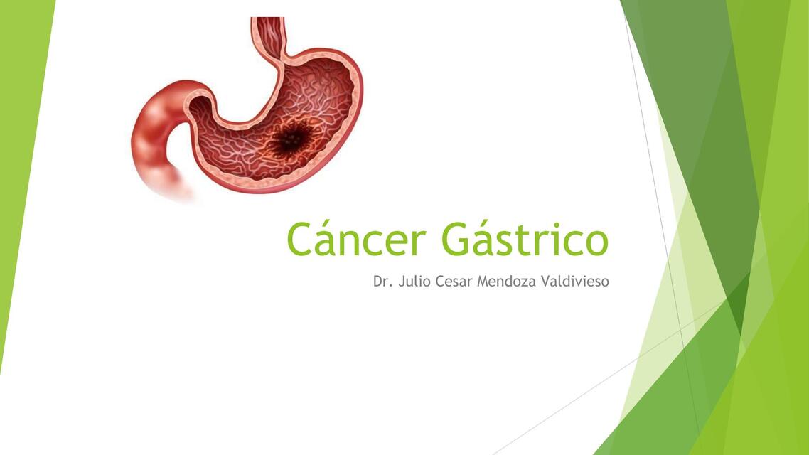 Cáncer Gástrico