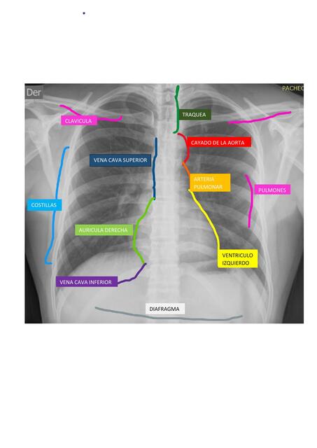 RADIOGRAFIA