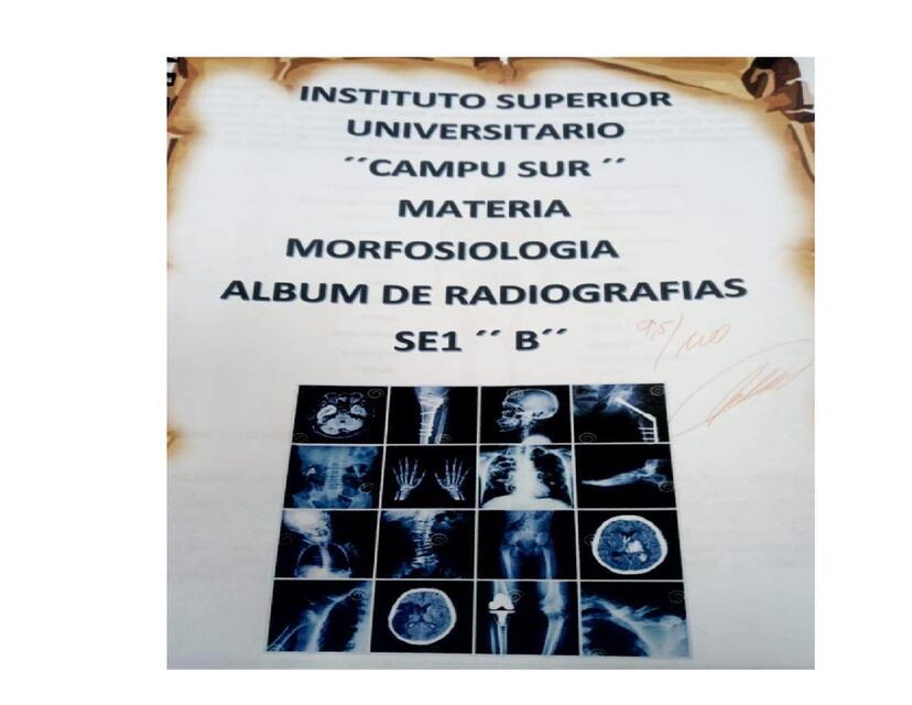 ÁLBUM DE RADIOGRAFÍAS MORFOFISIOLOGÍA