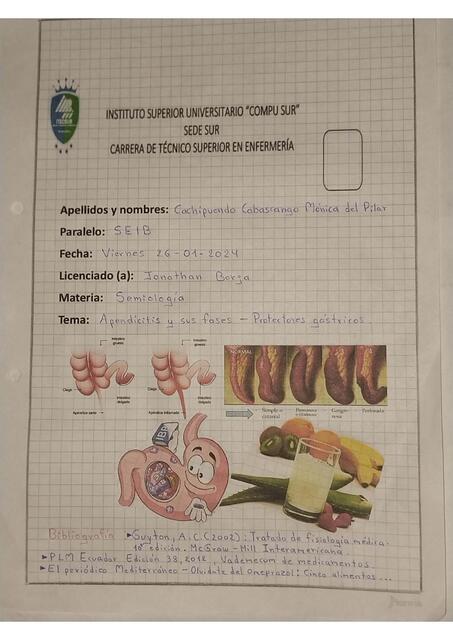 APENDICITIS Y SUS FASES PROTECTORES