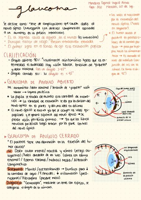 GLAUCOMA