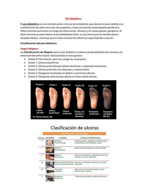 Pie Diabético clasificacion