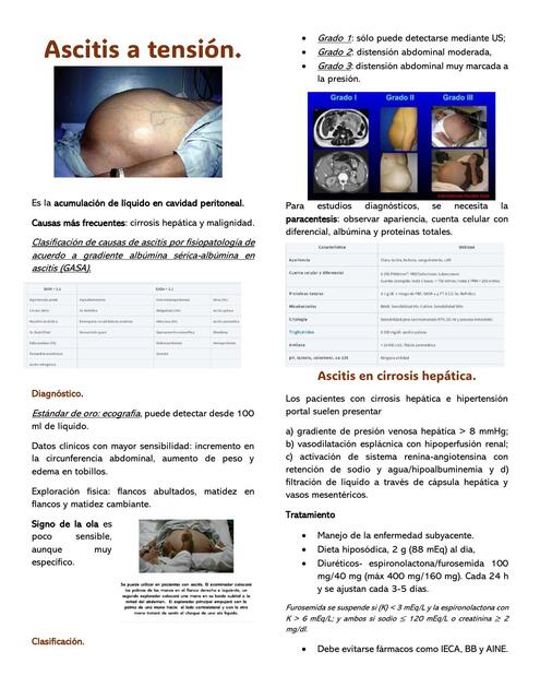 Ascitis a tensión urgencias