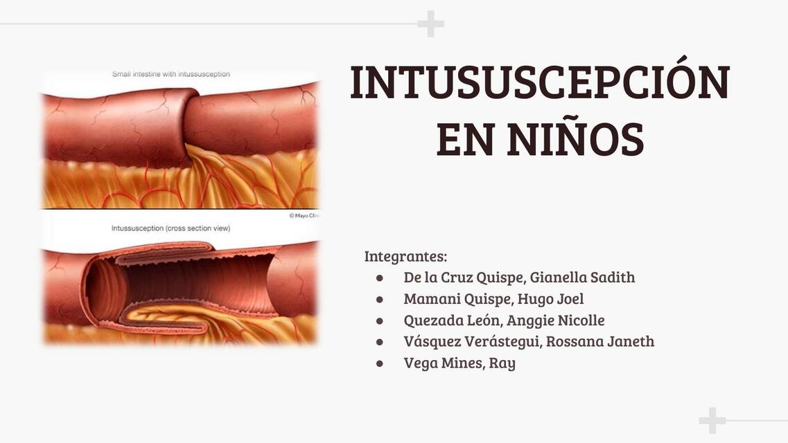 apendicitis y intususcepcion urgencias y emergenci