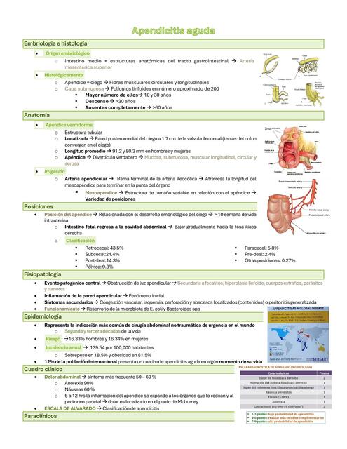 Apendicitis aguda