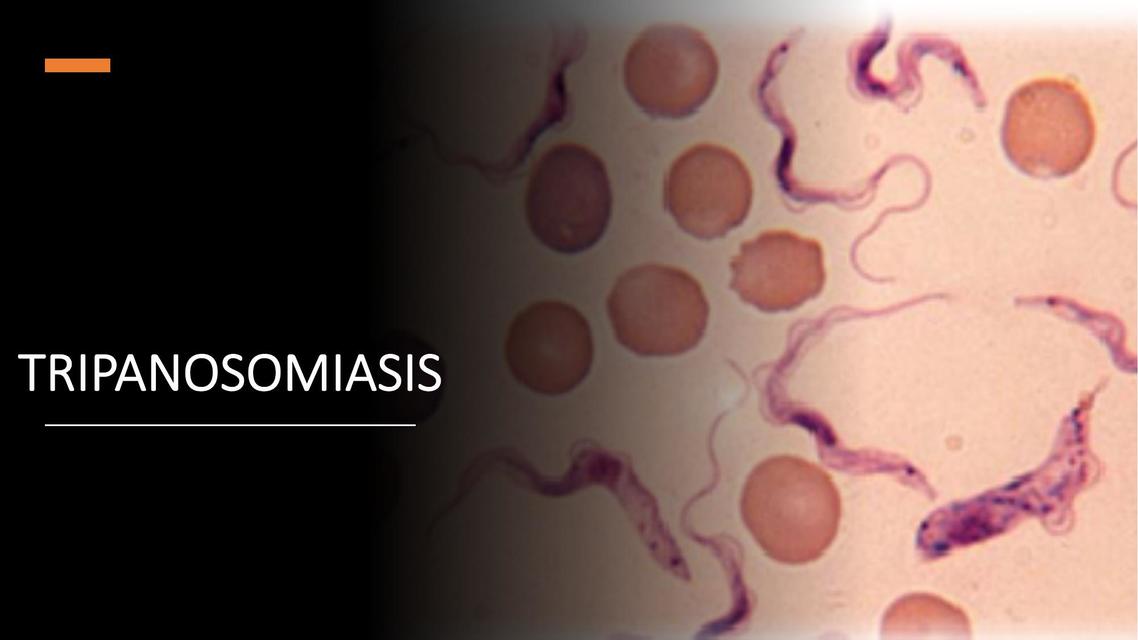 Tripanosomiasis