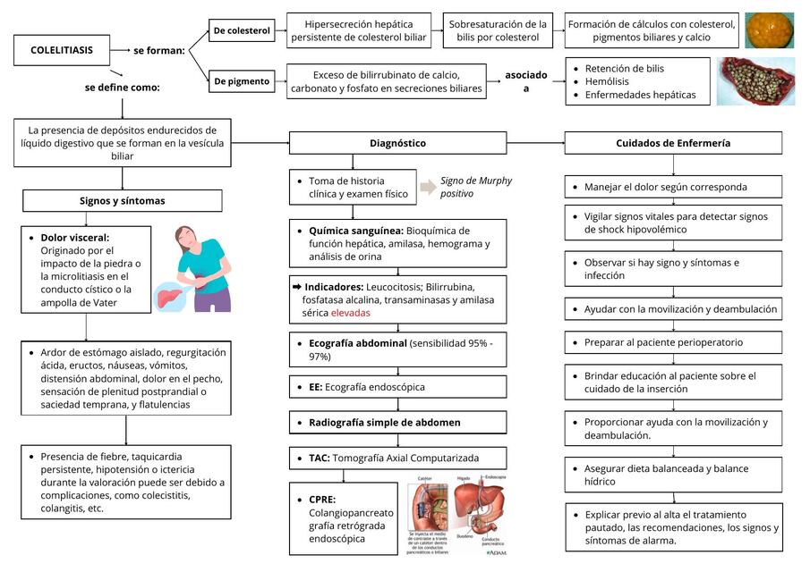 Colelitiasis y Pancreatitis