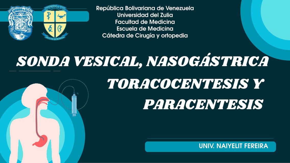 SONDAS, TORACOCENTESIS Y PARACENTESIS