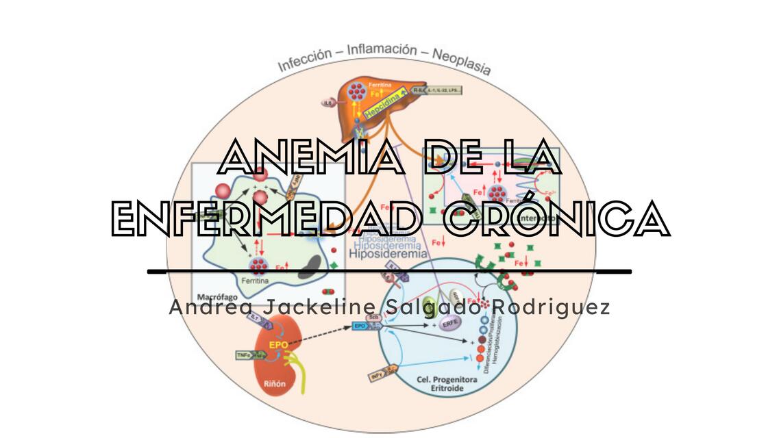 Anemia de la enfermedad crónica Presentación