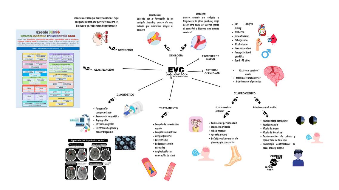 EVC ISQUEMICO