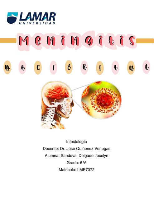 Meningitis bacteriana