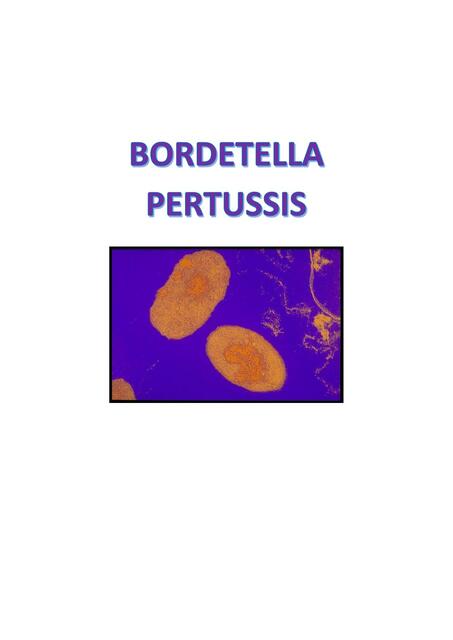 BORDETELLA INFECTOLOGIA