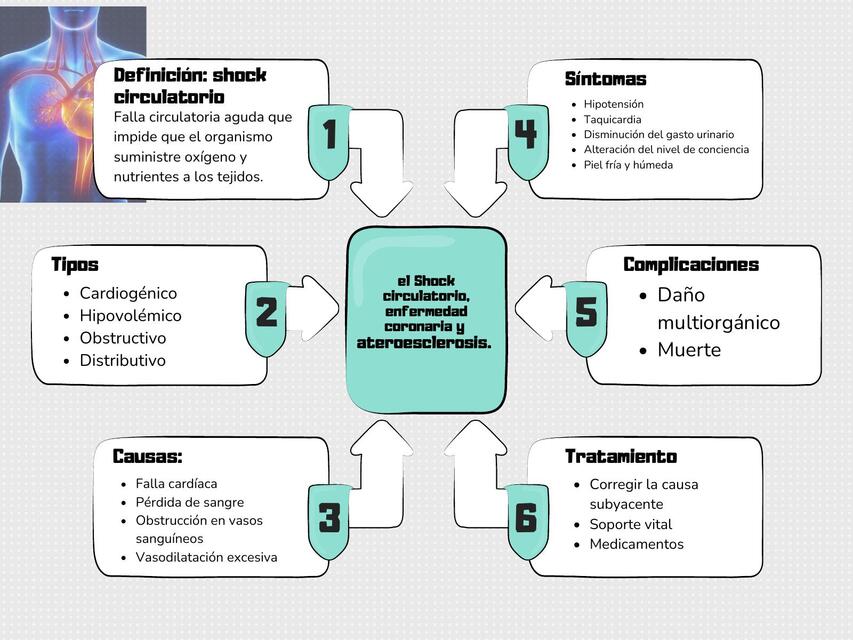 Elabora un mapa mental sobre el Shock circulatorio