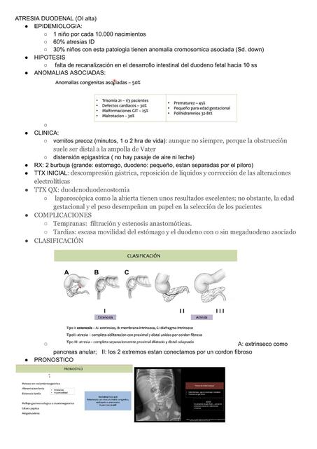 ATRESIA DUODENAL