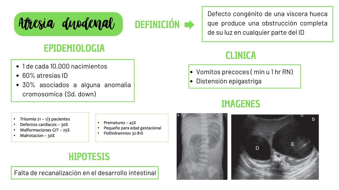 atresias intestinales neonatos