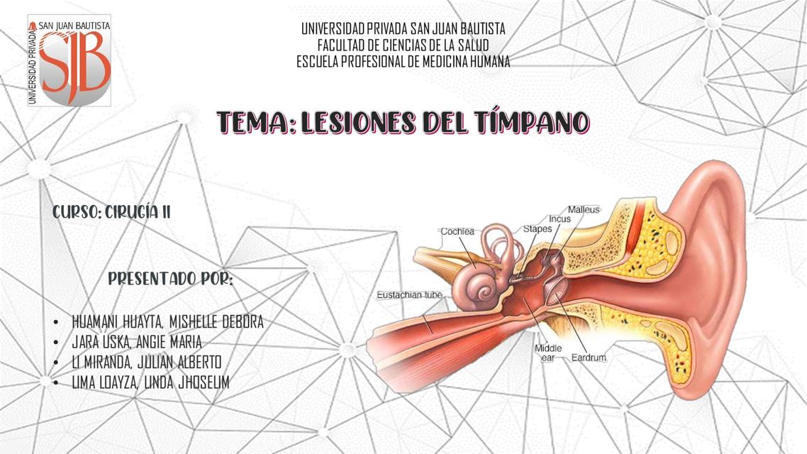 PERFORACIÓN DE TIMPANO Morales Lizeth uDocz