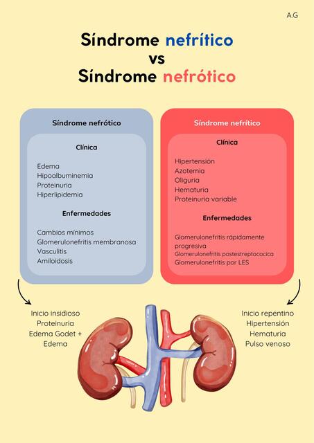 Síndrome nefrítico vs Síndrome nefrótico