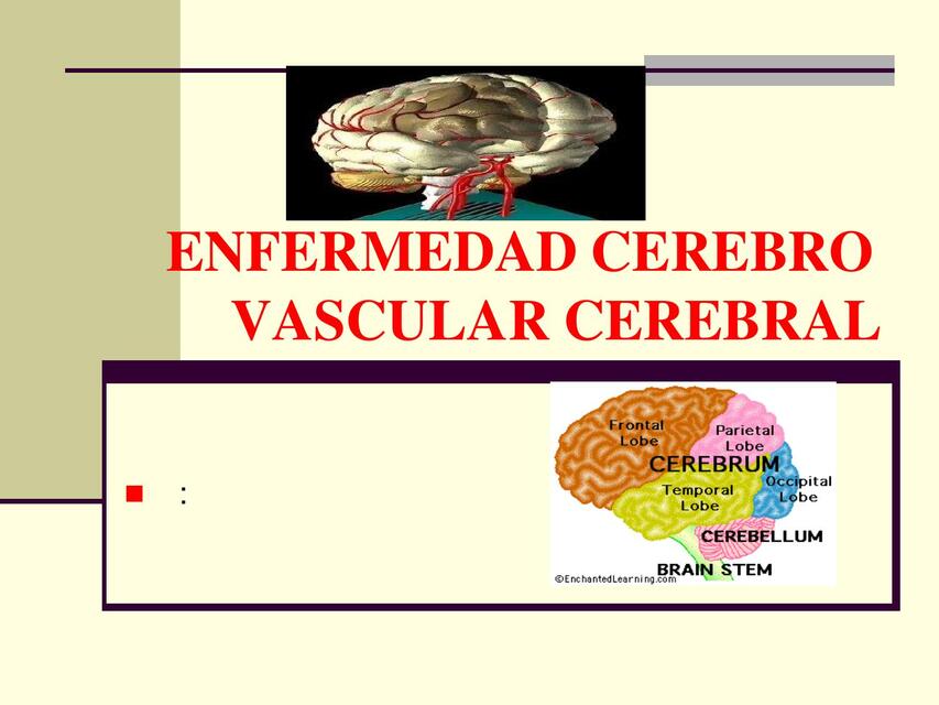 ENFERMEDAD CEREBRO VASCULAR