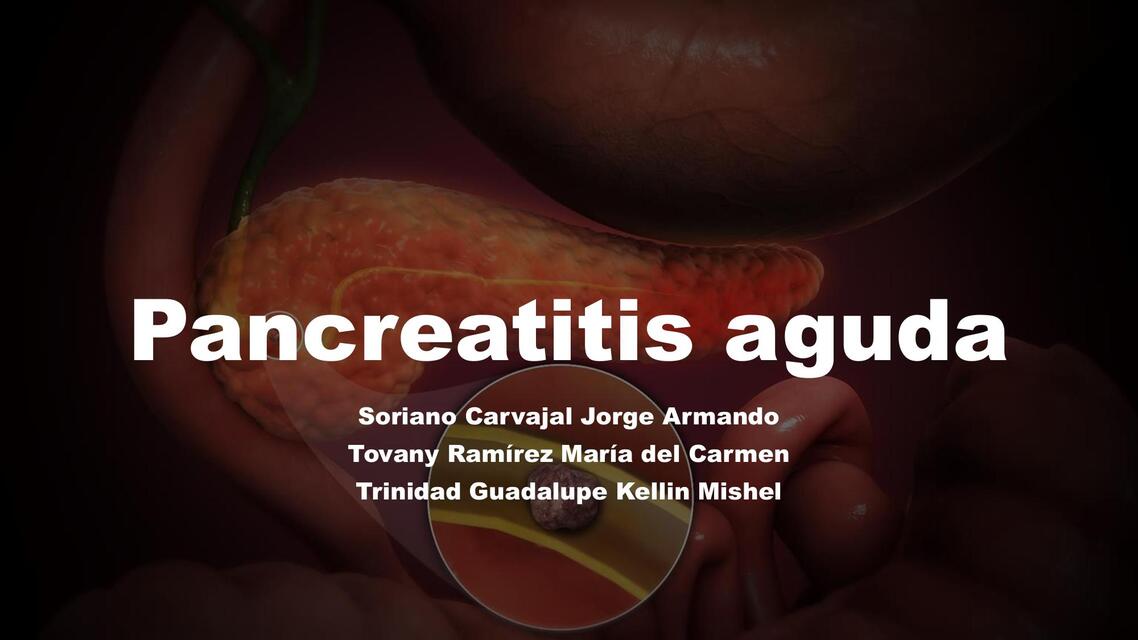 Pancreatitis aguda