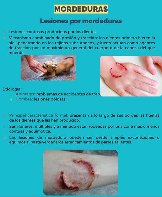 Lesiones por mordeduras