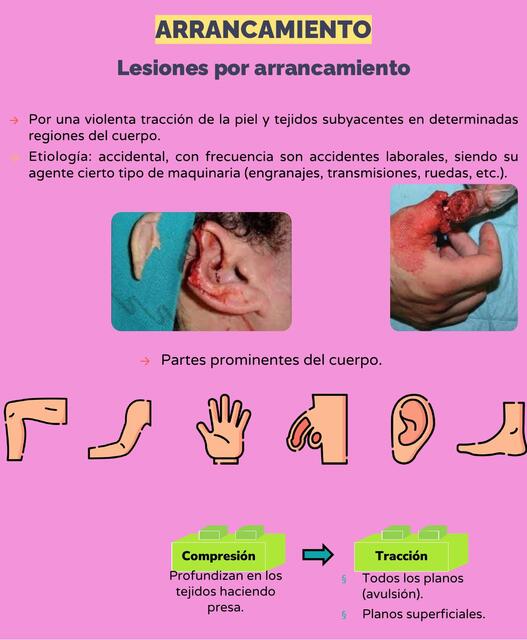 Lesiones por arrancamiento