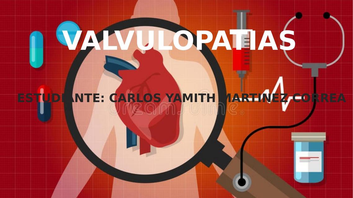 VALVULOPATIAS