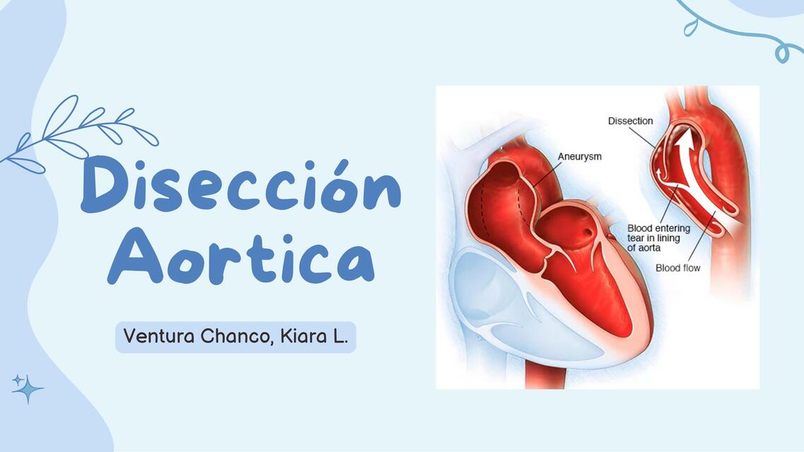 Disección aortica