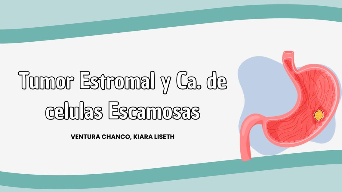 tumor estromal y cancer de celulas escamosas