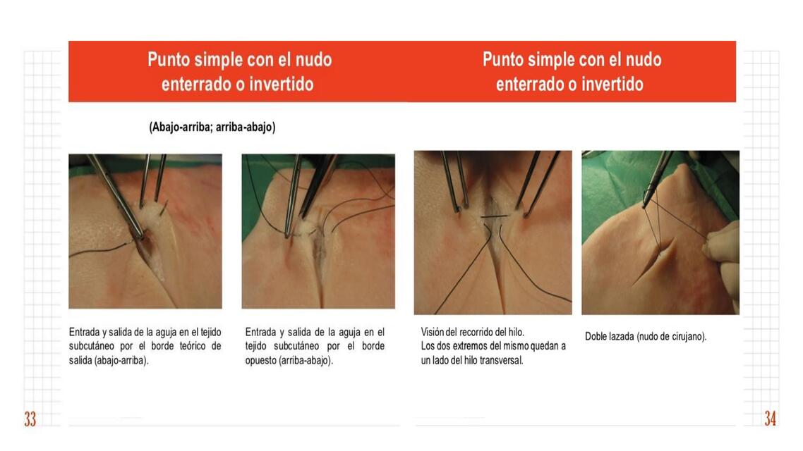 PUNTOS DE SUTURA