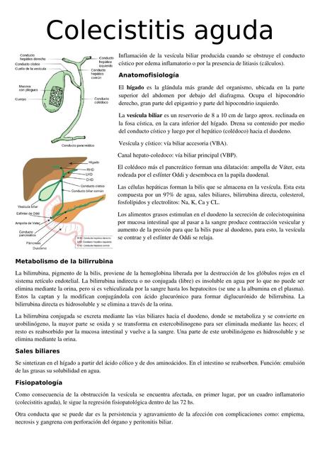 Colecistitis