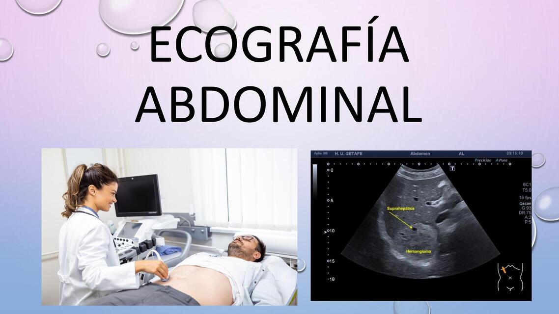 Ecografía abdominal