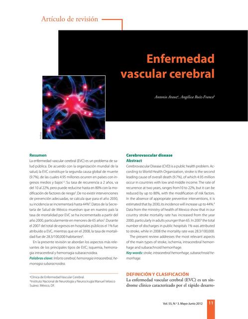 Artículo de enfermedad cerebrovascular