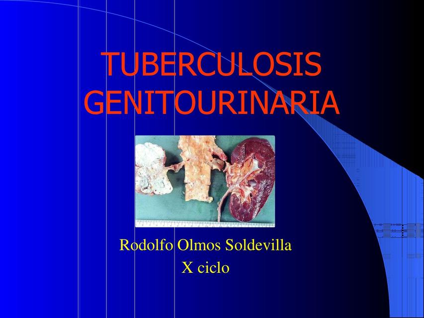 Tuberculosis genitourinaria